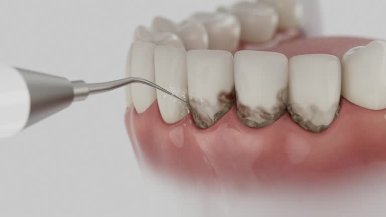 Reliable Wisdom Tooth Removal contractor in Larimer County County, CO by Dentist Open Now